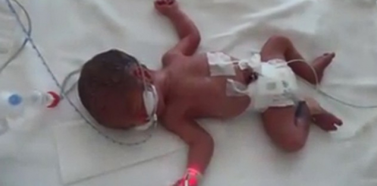 Kayseri ehir Hastanesi'nin ilk drdz bebekleri dnyaya geldi