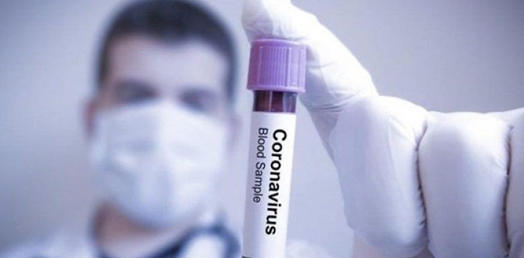 Almanyada koronavirs nedeniyle 2 kii hayatn kaybetti