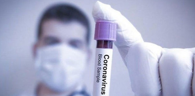 orum Valilii: 497 koronavirs testinin 29'u pozitif, 1 can kayb var